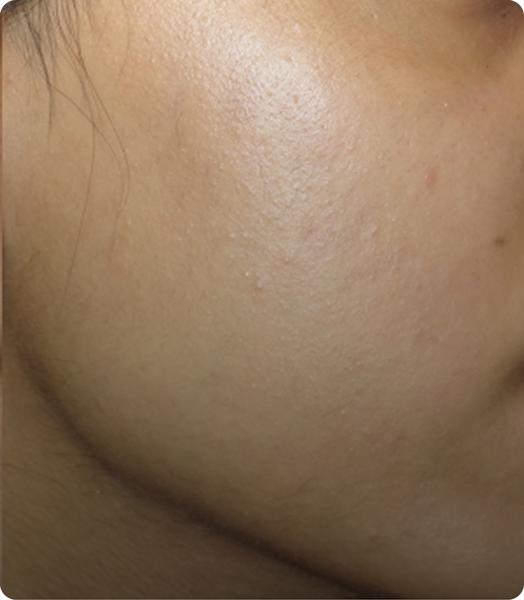 Rectangle sdfg Rectangle sdfg